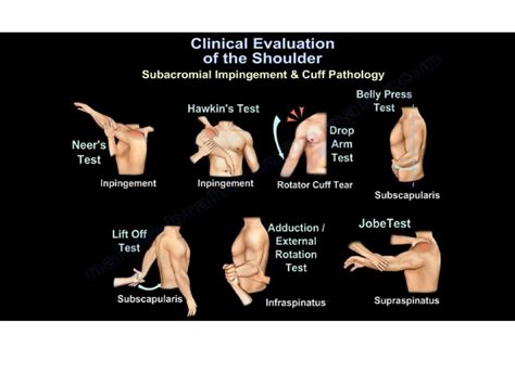 shoulder capsule tear test|shoulder exam pdf.